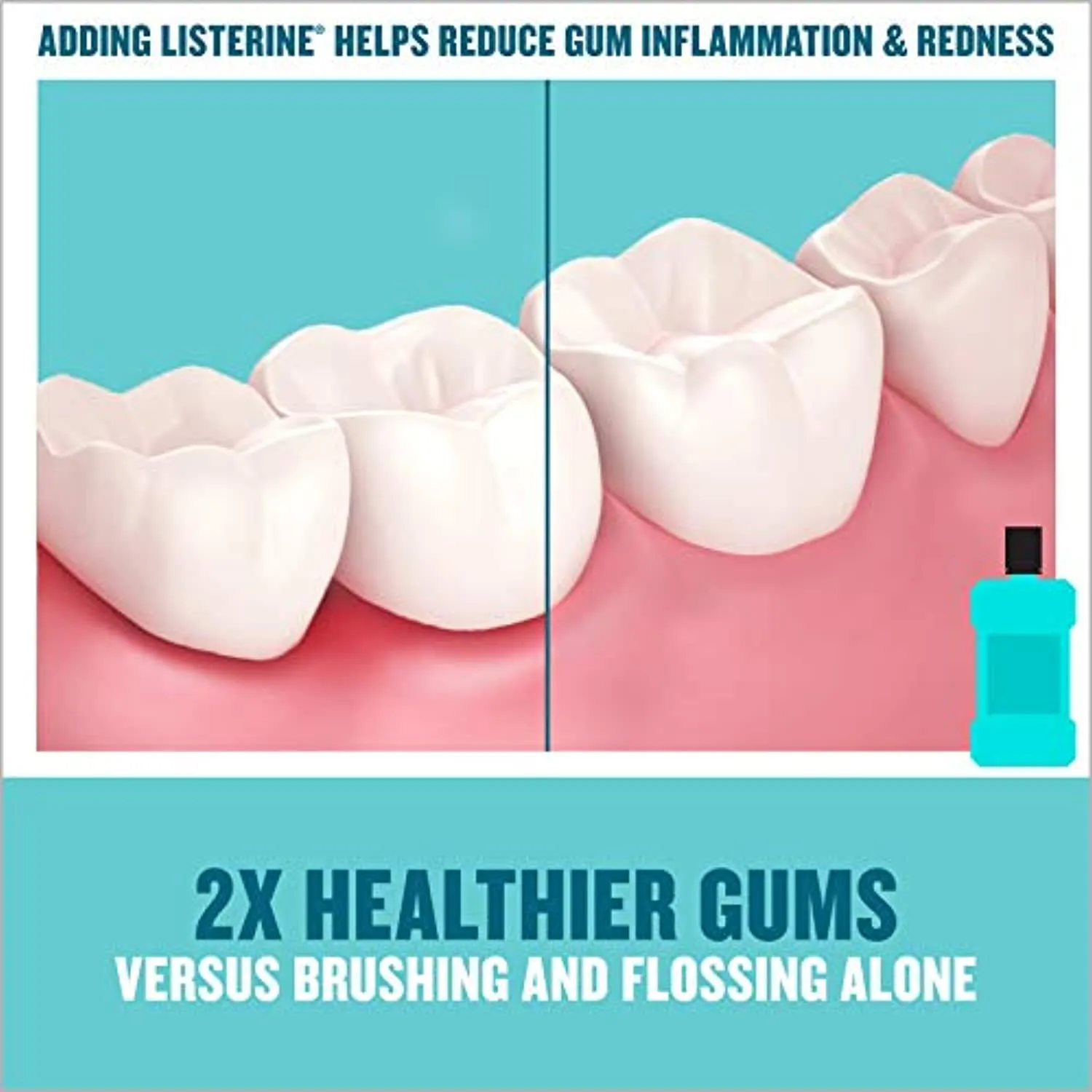 Listerine Ultraclean Oral Care Antiseptic Mouthwash with Everfresh Technology to Help Fight Bad Breath, Gingivitis, Plaque and Tartar, Cool Mint, 500 ml